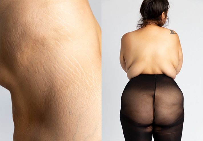 she_nathalie_zimmermann_underneath_unter_der_oberfläche